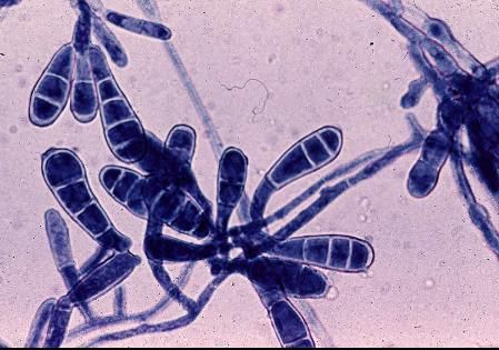 สาเหตุของโรคเชื้อราที่ขาหนีบ (Epidermophyton floccosum)